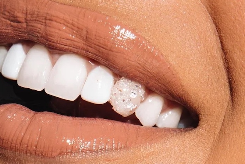 The Hudson Valley Tooth Fairy tooth gems and whitening
